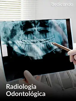 Curso de Auxiliar de Saúde Bucal • 100% Online • Certificado Reconhecido pelo CFO e CRO em até 30 dias modulo 12 radiologia odontologica.webp